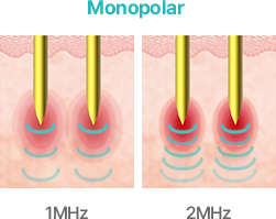 Monopolar